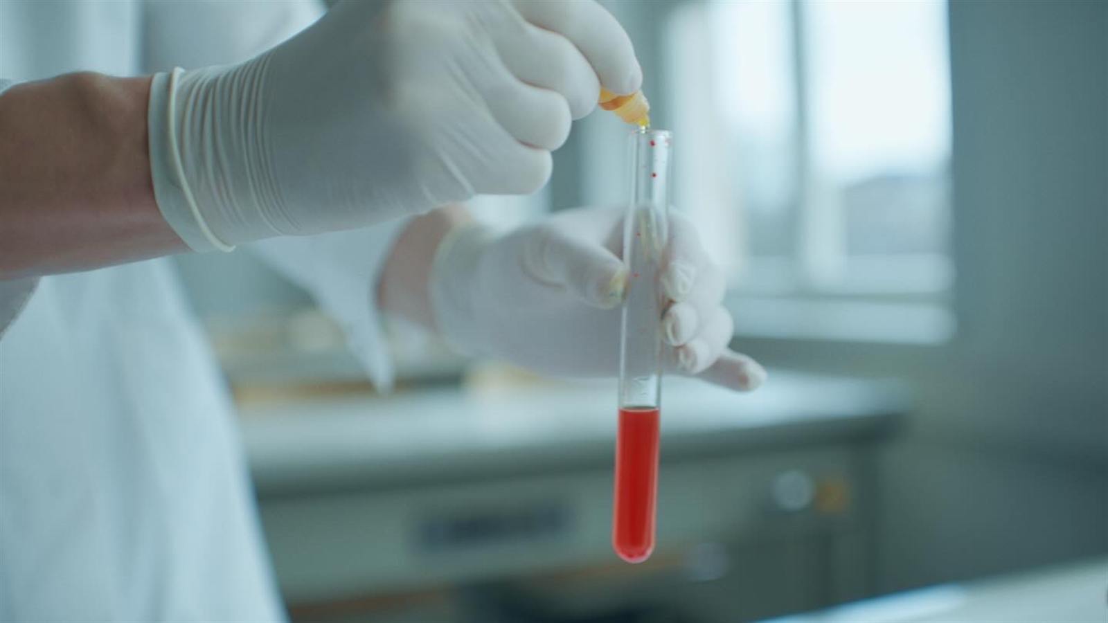 Behandschuhte Hände halten ein Reagenzglas mit roter Flüssigkeit